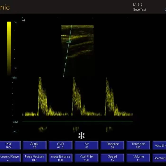 Portable B W Ultrasound Scanner for Veterinary Use with Animal Pre-set Modes for Cat Dog Cattle Horse — image 5