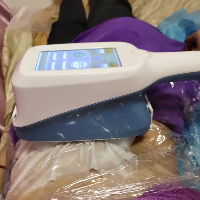 Body Shaping Vacuum Vertical Cryo Discount Offer Cryo Therapy Rf Cryo 360 Cryolipolysis Cool Slimming Machine — image 7
