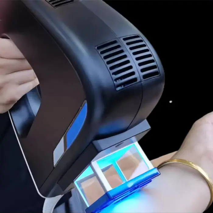 "High-Power 500W Portable Excimer Laser Equipment for Commercial Skin Diseases Treatment & Surgery" — image 6