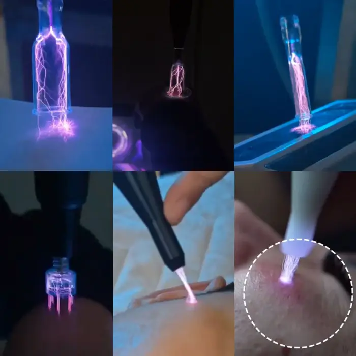 2626 Newest Cold Plasma Machine Beauty for Face Plasma Pen Acne Treatment Skin Repair Plasma Skin Anti-aging Cold Plasma Device — image 4