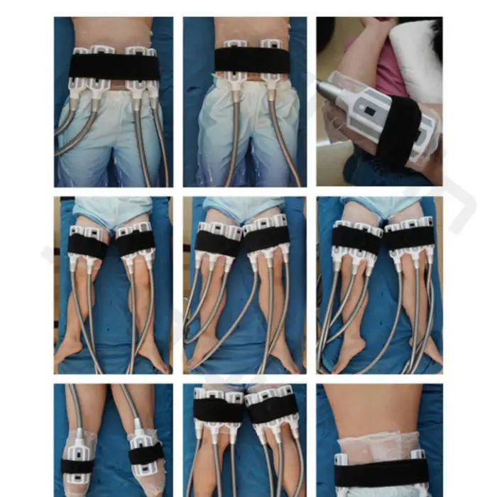 8 Handles Cryotherapy Cyrolipolysis Cyrotherapy 360 Cryolipolysis Slimming Fat Freezing Machine Cryo Beauty Salon Equipment — image 7
