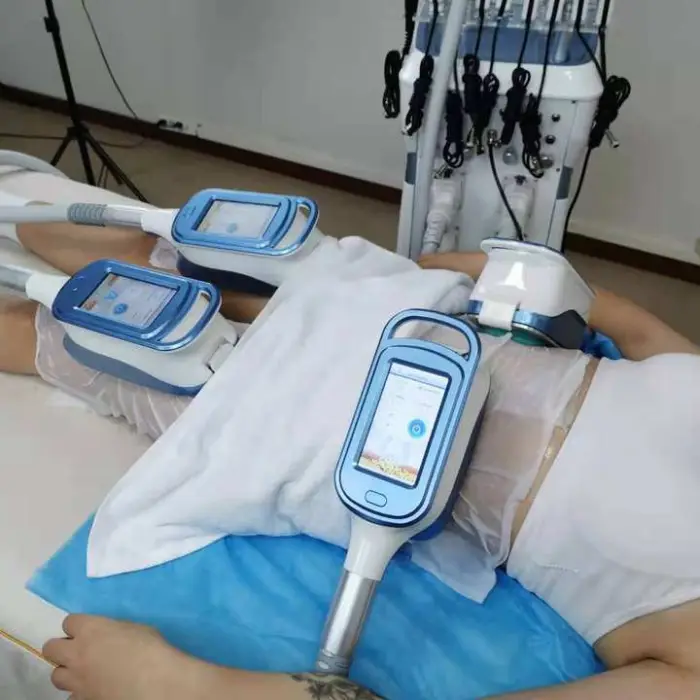 360 Degree 5 Heads Fat Freezing Slimming Machine With RF Cavitation and Lipo Laser — image 7