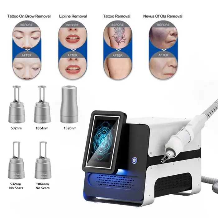 Portable Picosecond Laser Machine Picosecond Laser Machine Tattoo Hair — image 4