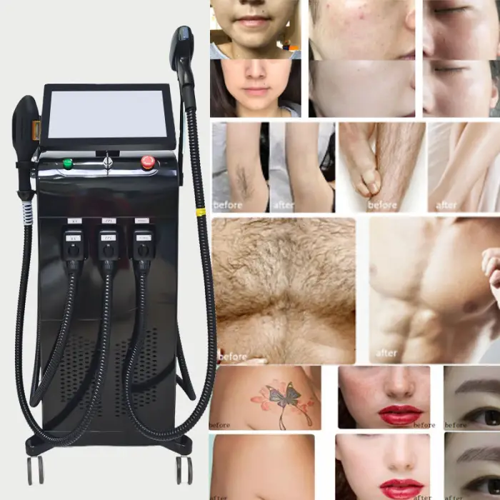 Multi-function 4-in-1 Diode Laser IPL Rf Laser Hair Removal Machine Construction for Body Hair Removal Skin Tightening — image 5