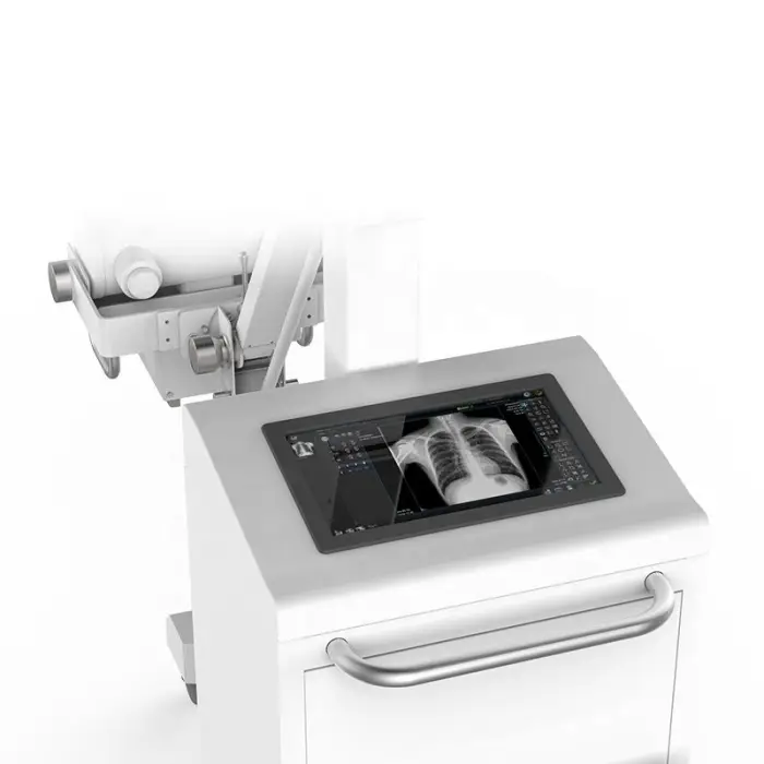 YSX-mDR20B Ysenmed Mobile Digital X Ray Machine Electric 40-120KV 10-400mA High Quality Medical Equipment — image 4