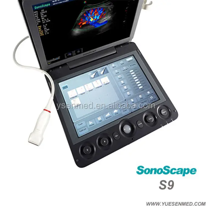 Sonoscape S9 Portable 3D 4D Color Doppler Ultrasound Scanner USG Machine — image 3