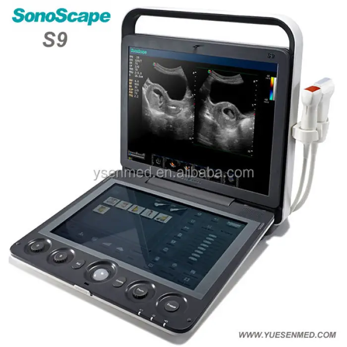 Sonoscape S9 Portable 3D 4D Color Doppler Ultrasound Scanner USG Machine — image 4
