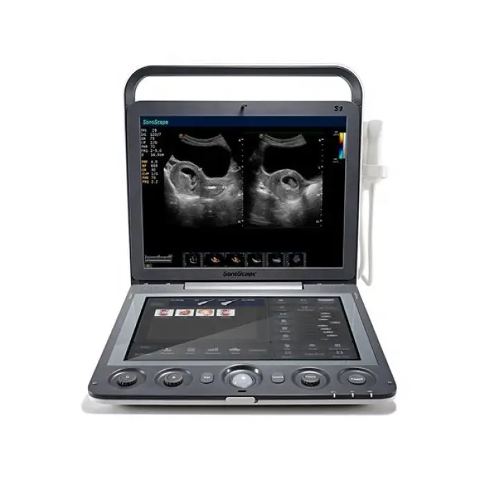 Sonoscape S9 Portable 3D 4D Color Doppler Ultrasound Scanner USG Machine — image 7