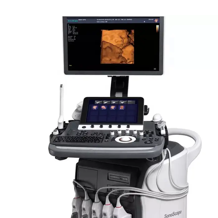 Sonoscape P50 Elite Trolley 2D 3D 4D Color Doppler Convex and Linear Wireless Ultrasound Scanner Sonoscape Ultrasound P50 New — image 4