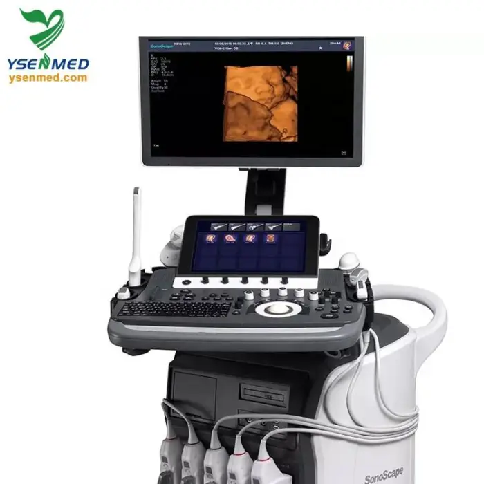 Sonoscape P50 Elite Trolley 2D 3D 4D Color Doppler Convex and Linear Wireless Ultrasound Scanner Sonoscape Ultrasound P50 New — image 7