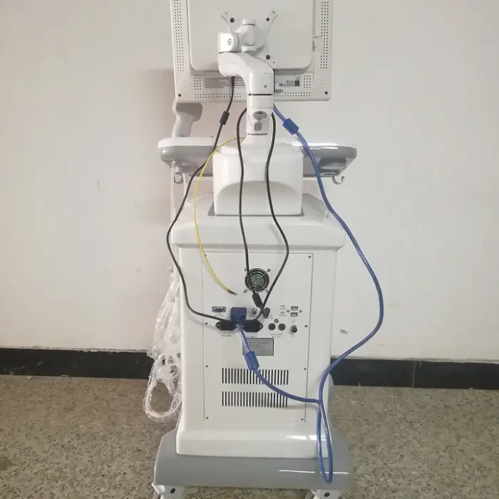 YSB850 Ysenmed Black and White Uorology Ultrasound Medical Ultrasound Combination B/w Mode Hospital and Clinic Ultrasound Device — image 3