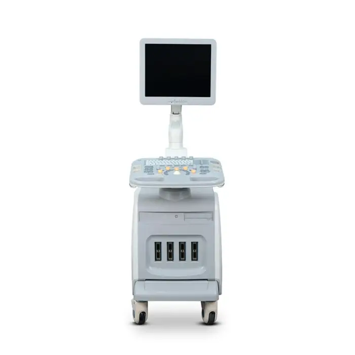 Chison I3 Medical Dopler Ultrasound Other Ultrasound Optical Electronic Exam Chison I3 Mobile 3d 4d Ultrasound Machine Price — image 3