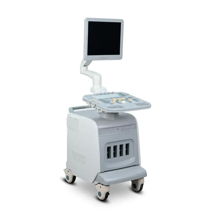 Chison I3 Medical Dopler Ultrasound Other Ultrasound Optical Electronic Exam Chison I3 Mobile 3d 4d Ultrasound Machine Price — image 5