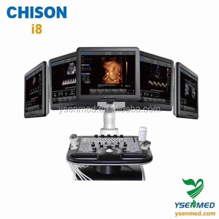 Chison I8 Medical Trolley Pregnant Ultrasound 3d 4d Ultrasound Color Doppler Chison I8 Mobile Color Transesophageal Ultrasound — image 5