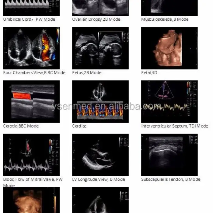Chison I8 Medical Trolley Pregnant Ultrasound 3d 4d Ultrasound Color Doppler Chison I8 Mobile Color Transesophageal Ultrasound — image 7