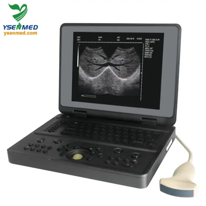 YSB3000W Ysenmed Portable B/W Notebook Ultrasound Machine with Convex Probe Electric Power 12-inch TFT Color LCD Display — image 3