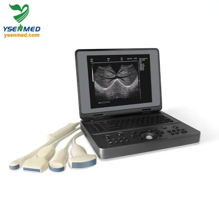 YSB3000W Ysenmed Portable B/W Notebook Ultrasound Machine with Convex Probe Electric Power 12-inch TFT Color LCD Display — image 4