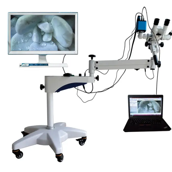 China Colposcope Gynecological Equipment Portable Video Colposcope Gynecological Colposcope Supplier for Sale — image 4