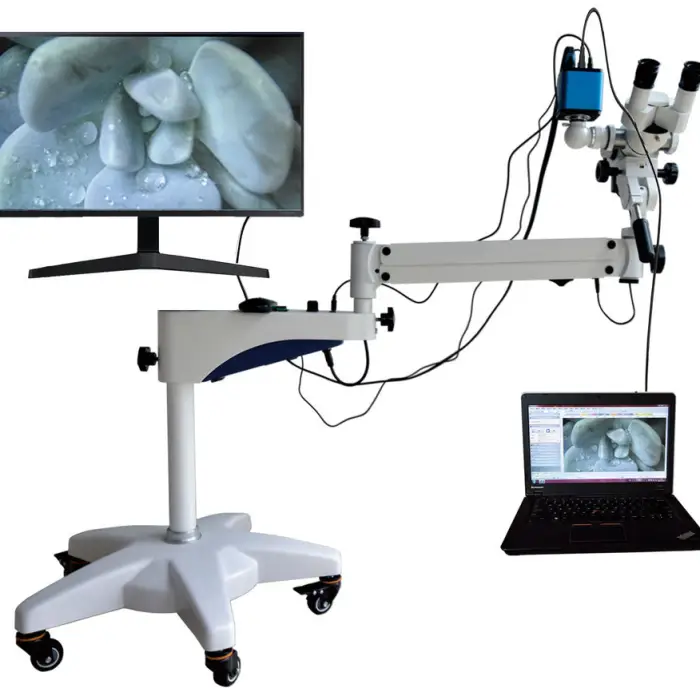 China Colposcope Gynecological Equipment Portable Video Colposcope Gynecological Colposcope Supplier for Sale — image 5