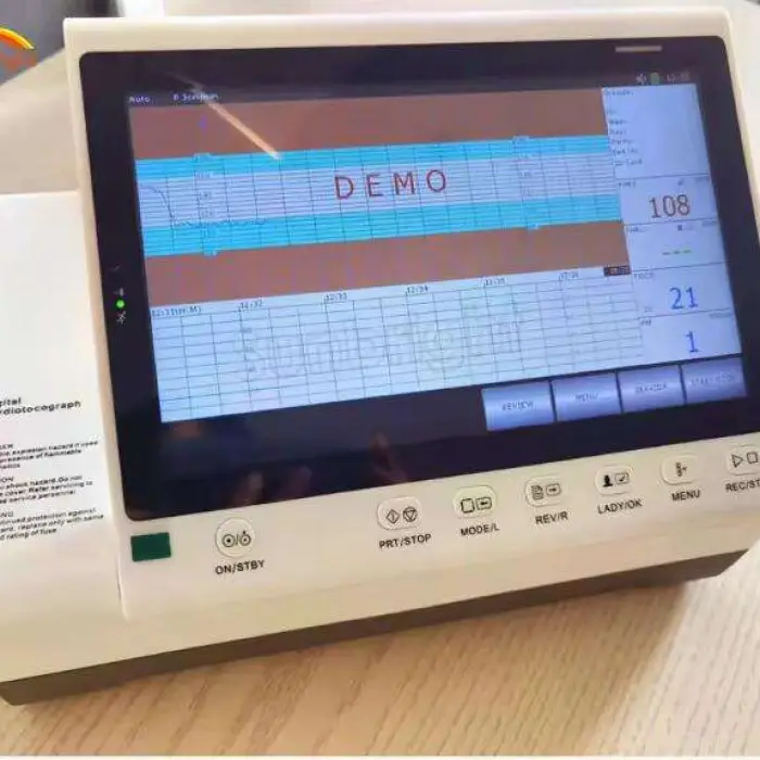 Good Quality Portable 10" Touch Screen Sunbright Fetal Twins Maternal Monitor CTG Fetal — image 4