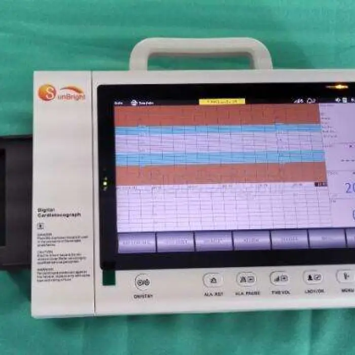 Good Quality Portable 10" Touch Screen Sunbright Fetal Twins Maternal Monitor CTG Fetal — image 7