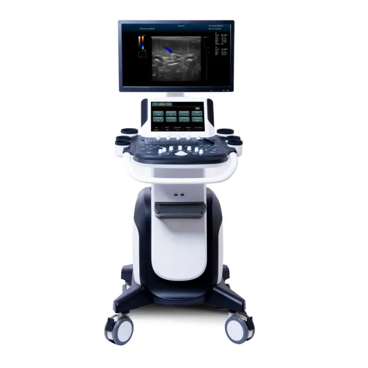 Hospital Color Doppler Ultrasound Scanner Electric Equipment for Human Use Made of Metal and Plastic — image 6