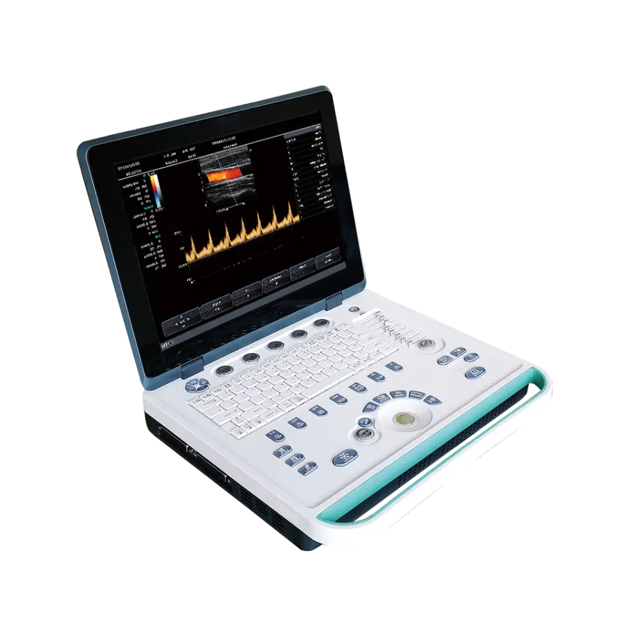 Portable 4D/5D Color Doppler Ultrasound Machine Clinics Hospitals Electric Metal Portable Doppler Ultrasound Machine 3D — image 6