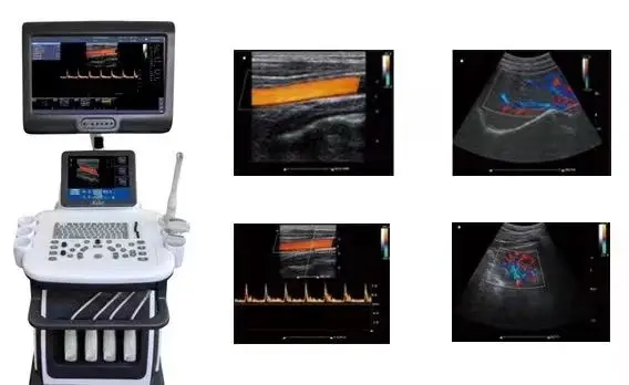 Factory Wholesale 4D Color Ultrasound Machine Portable Doppler Echo Device for Obstetrics and Cardiology Electric Power — view 5