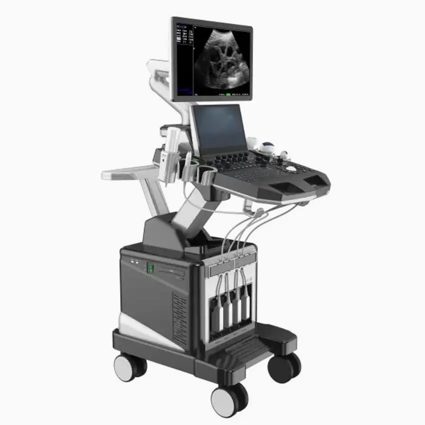 UMY UM-T50 Electric Portable Metal Color Ultrasonic Diagnostic Ultrasound Machine with 21.5" LED + 13.3" Touch Screen Movable — image 5