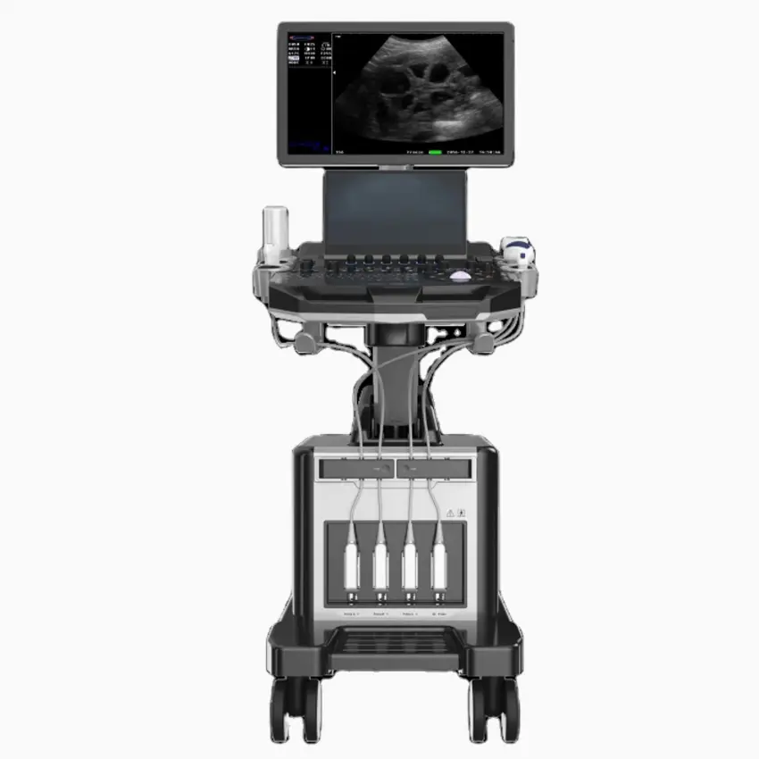 UMY UM-T50 Electric Portable Metal Color Ultrasonic Diagnostic Ultrasound Machine with 21.5" LED + 13.3" Touch Screen Movable — image 6