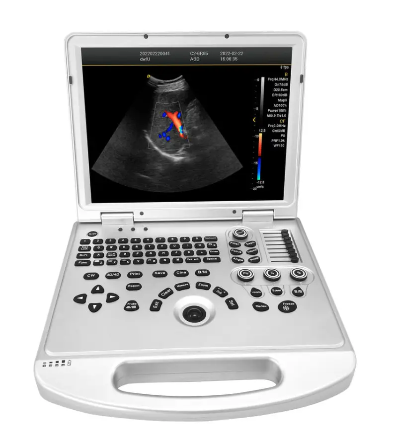 Portable Color Doppler Ultrasound Machine Electric Diagnostic Ultrasound with Metal and Plastic Materials — image 2
