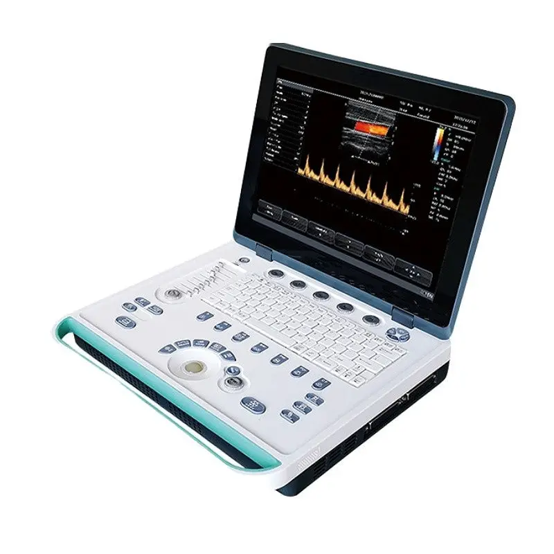 Portable 3D 4D Ultrasound for Medical Diagnostic Imaging Center Using Color Ultrasound for Gynecology — image 6