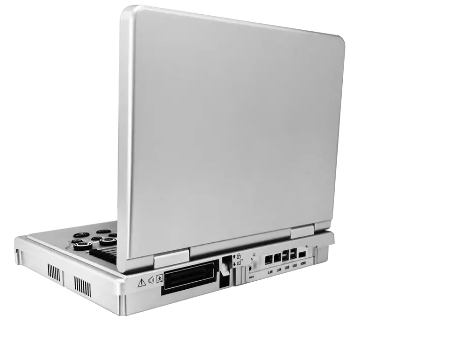 Portable Color Doppler Ultrasound Machine Electric Diagnostic Ultrasound with Metal and Plastic Materials — image 3