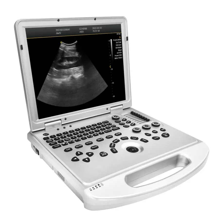 Portable Color Doppler Ultrasound Machine Electric Diagnostic Ultrasound with Metal and Plastic Materials — image 5