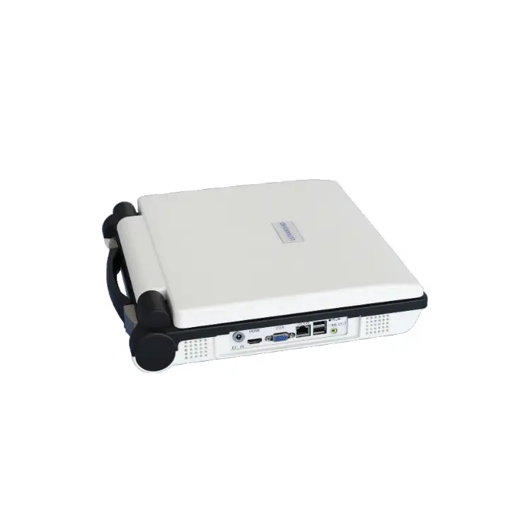 3D/4D Color Doppler Laptop Ultrasound Scanner with Convex Array Probe Portable Doppler Ultrasound Scanner for Human Use — view 3