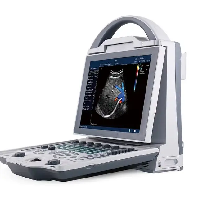 Human Use Medical Diagnostic Imaging Equipment Portable 2d 3d Ultrasound Scanner B/W Dp10 Ultrasound Machine — view 1