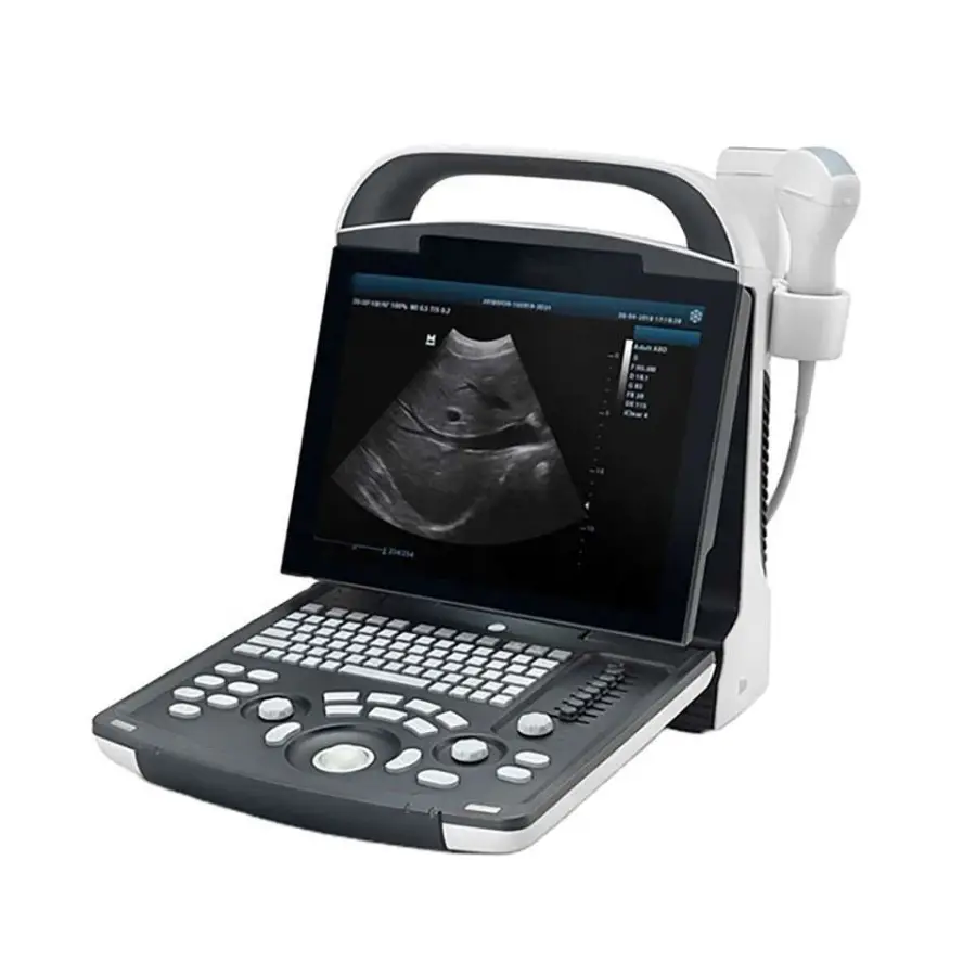 Human Use Medical Diagnostic Imaging Equipment Portable 2d 3d Ultrasound Scanner B/W Dp10 Ultrasound Machine — image 3