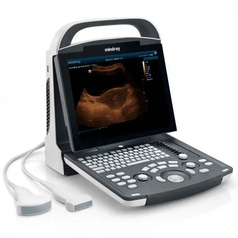 Human Use Medical Diagnostic Imaging Equipment Portable 2d 3d Ultrasound Scanner B/W Dp10 Ultrasound Machine — image 4