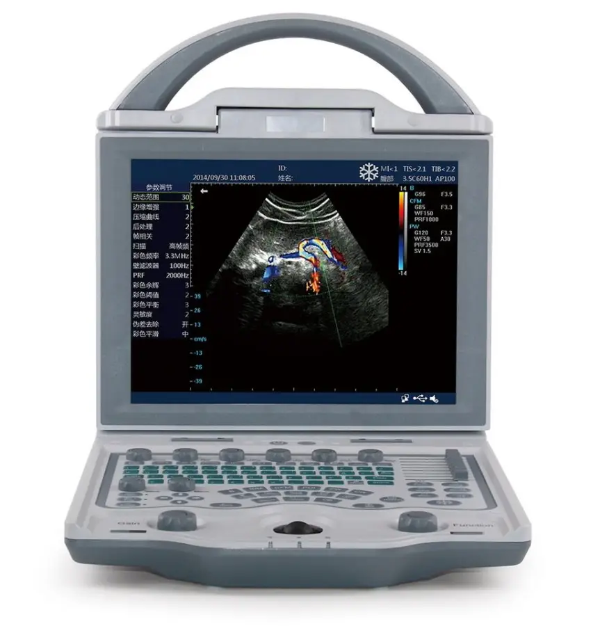Human Use Medical Diagnostic Imaging Equipment Portable 2d 3d Ultrasound Scanner B/W Dp10 Ultrasound Machine — image 5