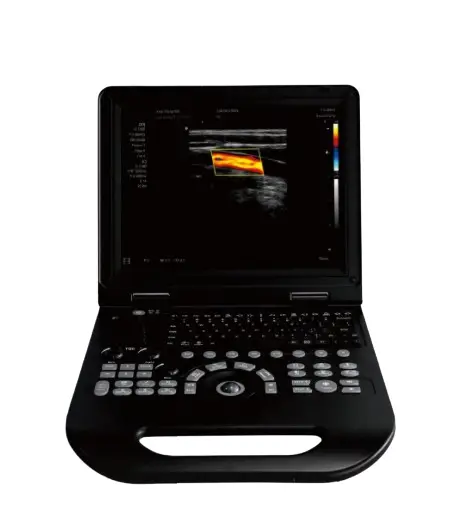Portable 15-Inch Color Doppler Ultrasound Machine with Probes Medical Imaging Instruments for Hospital Clinic — view 1