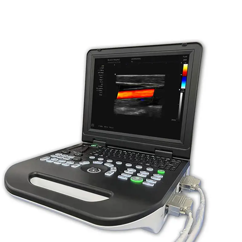 Portable 15-Inch Color Doppler Ultrasound Machine with Probes Medical Imaging Instruments for Hospital Clinic — image 7