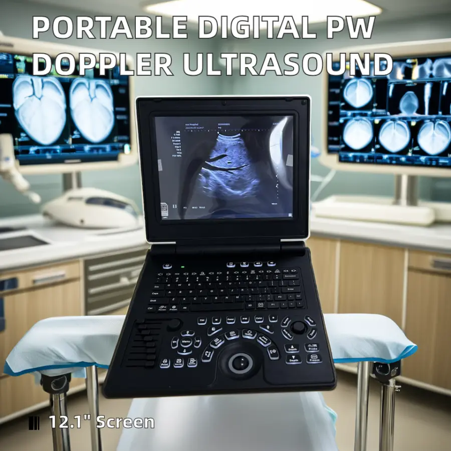 Portable Digital Ultrasound Scanner Machine Color Doppler PW Diagnostic Equipment Reusable Electric Power Source for Vet — view 3
