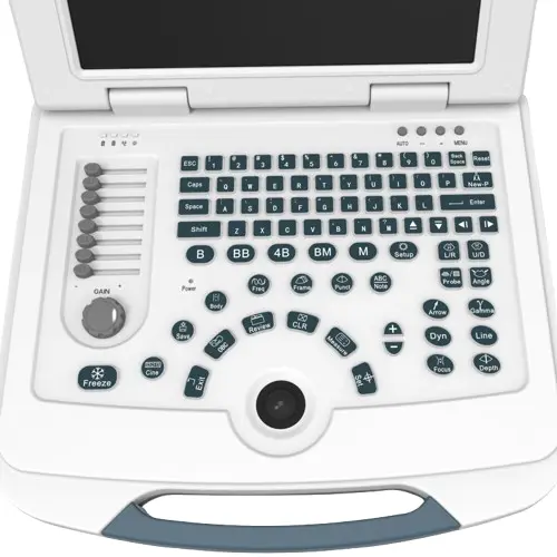 Portable Electric Black and White Medical Ultrasound Machine with 12.1inch Monitor and 12 Months Warranty — image 6