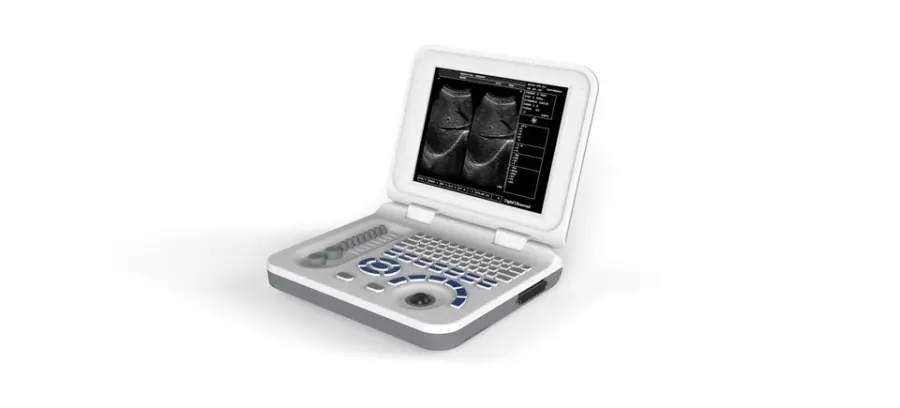 High Quality Professional Healthcare Imaging Ultrasound Machine New Arrival MH10-BW01 Medical Equipment Electric Power Sale — image 5