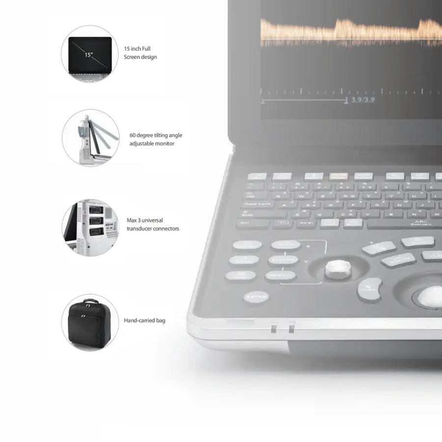 Medical Ultrasound Instruments Z50BW Portable Color Doppler 3d 4d Ultrasound System Scanner Digital Ultrasound — image 3