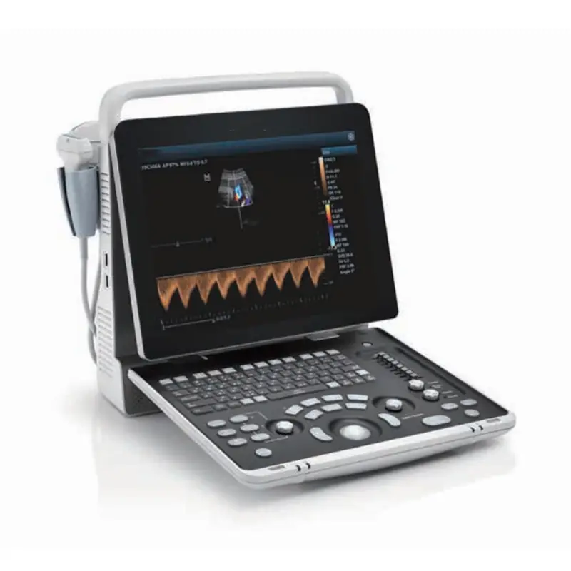UMZ50BW Electric Color Doppler Ultrasound Full Digital Portable Ultrasound Machine with LCD Display CE Certified — image 4