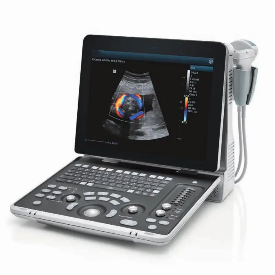 UMZ50BW Electric Color Doppler Ultrasound Full Digital Portable Ultrasound Machine with LCD Display CE Certified — image 5