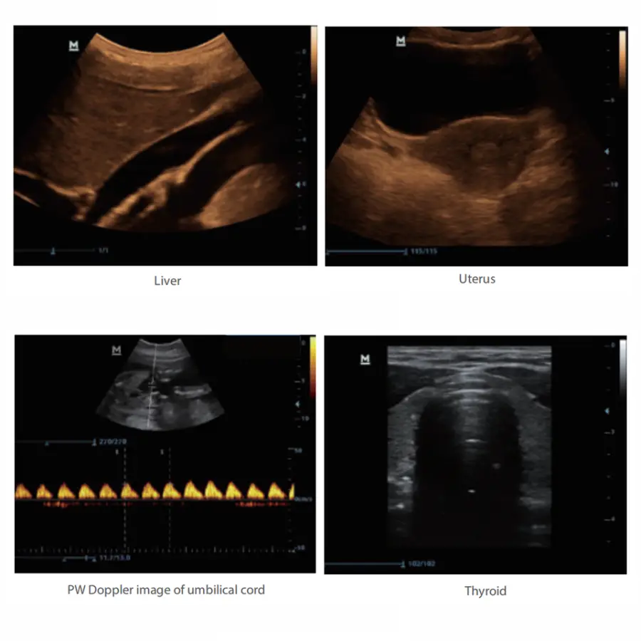 DP-10 Ultrasound Machine Black and White Imaging Diagnostic Machine With Compatible Convex Probe Transducerb dp10 — image 4