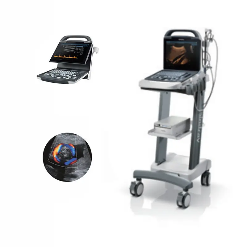 Medical Ultrasound Instrument Dp10 Dp20 Dp30 Digital Portable B/W High Resolution Ultrasound Scanner for Basic General — image 3