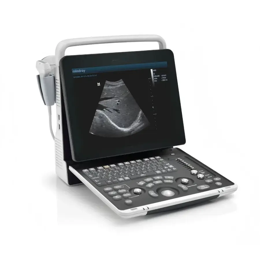 Portable B/W Dp-50 Ultrasound Machine DP50 Clinical Application Ultrasound Scanner Instrument Price — image 2